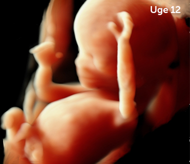 3D billede uge 12